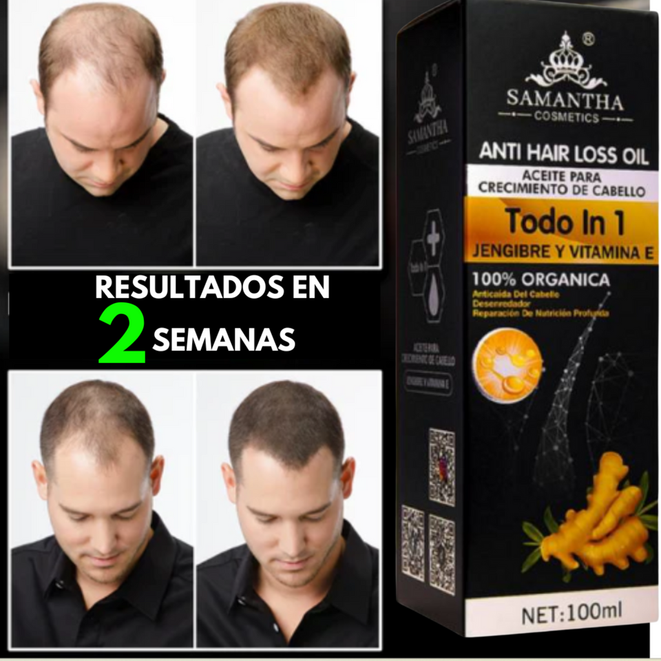 ACEITE PARA EL CRECIMIENTO DEL CABELLO